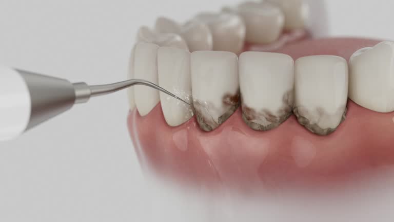 Trusted Dental Crowns And Bridges service in New Vienna, OH - Dentist Open Now